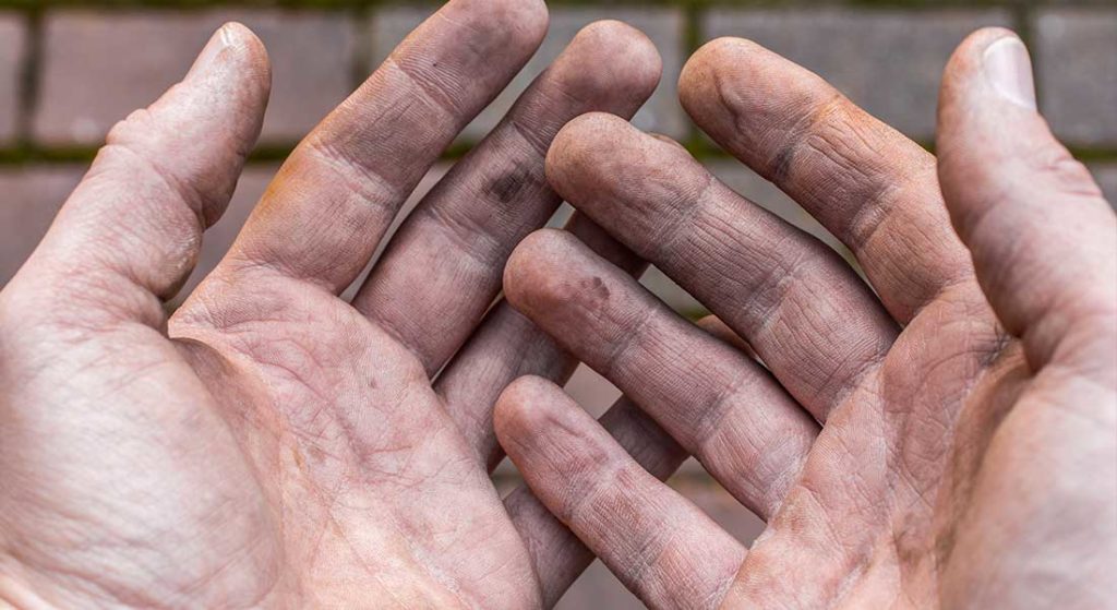 dirty hands as part of ERP therapy for OCD